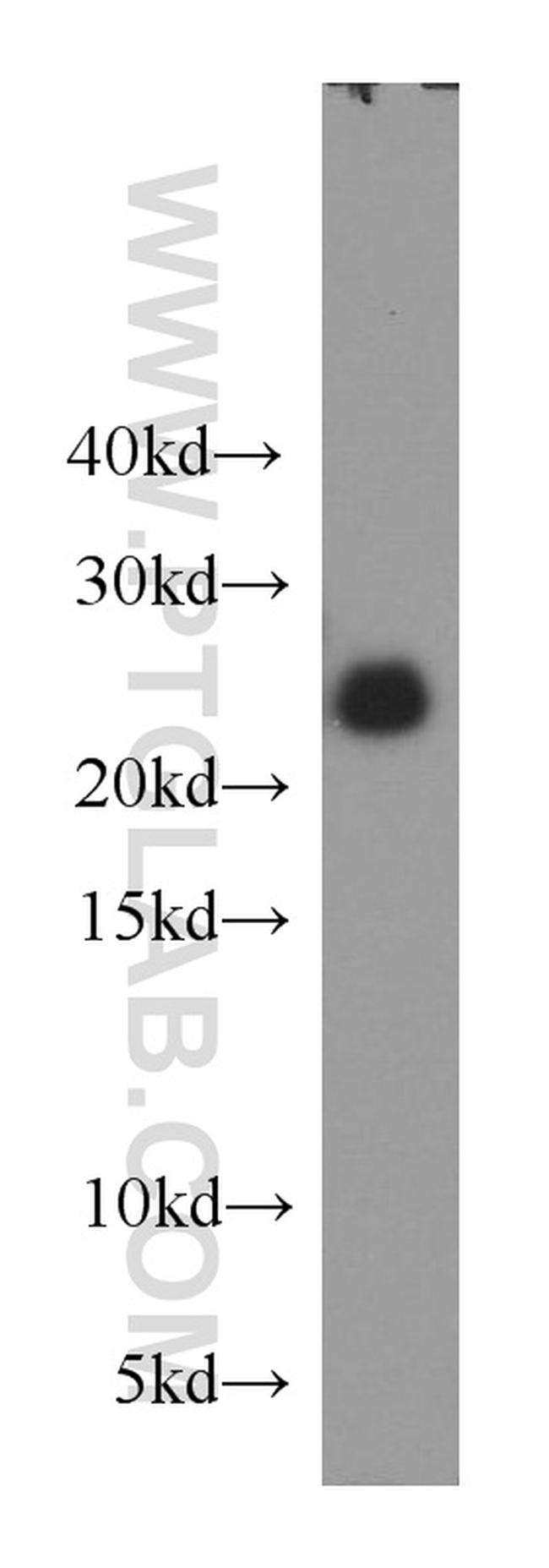 RAB39 Antibody in Western Blot (WB)