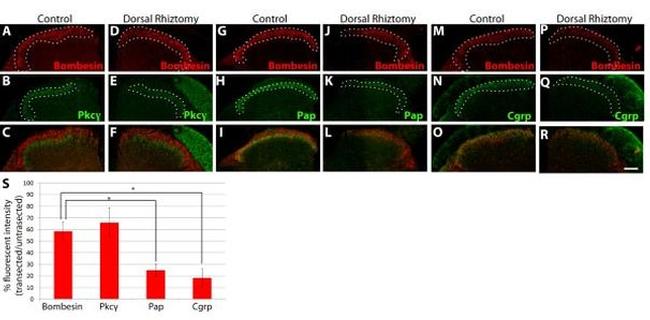 PKC gamma Antibody in Immunohistochemistry (Frozen) (IHC (F))