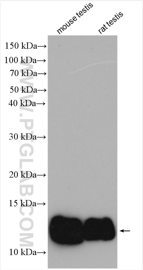 ACYP1 Antibody in Western Blot (WB)