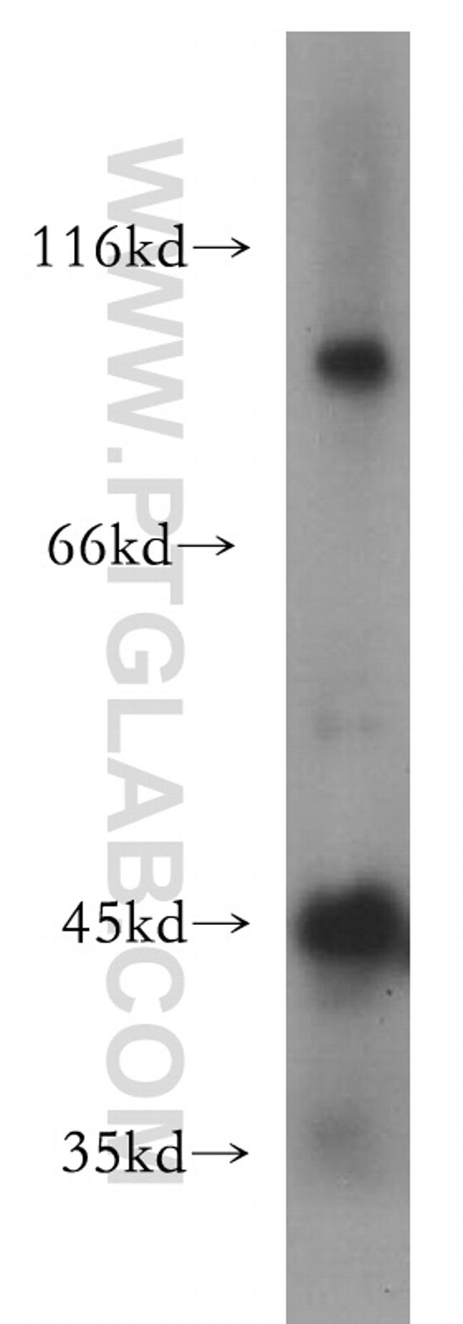 ACTL7B Antibody in Western Blot (WB)