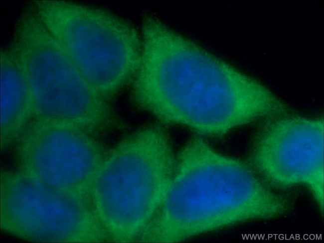 GZMB Antibody in Immunocytochemistry (ICC/IF)