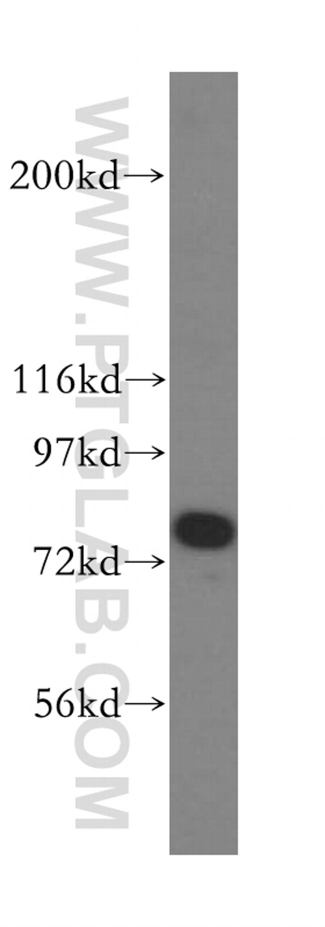 Syntaphilin Antibody in Western Blot (WB)
