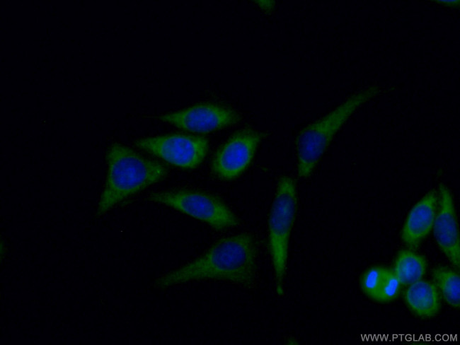 SEC24D Antibody in Immunocytochemistry (ICC/IF)