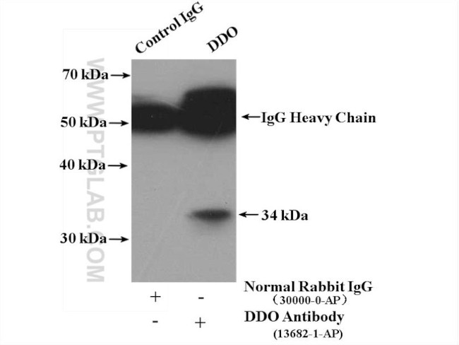 DDO Antibody in Immunoprecipitation (IP)