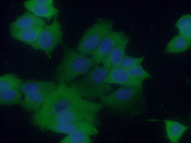 CCDC6 Antibody in Immunocytochemistry (ICC/IF)