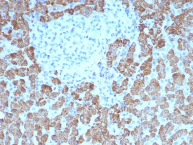 CPS1/Carbamoyl-Phosphate Synthetase (Hepatocellular Marker) Antibody in Immunohistochemistry (Paraffin) (IHC (P))