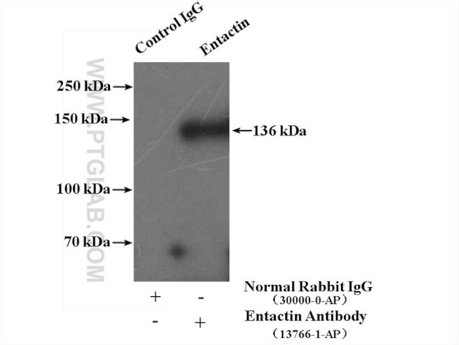 Entactin Antibody in Immunoprecipitation (IP)