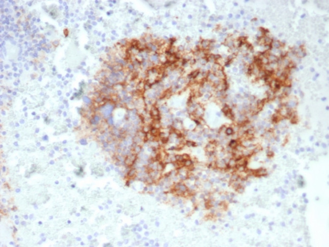 CD35/CR1 (Follicular Dendritic Cell Marker) Antibody in Immunohistochemistry (Paraffin) (IHC (P))