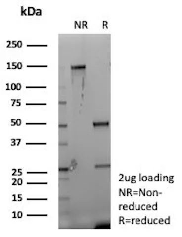 CD35/CR1 (Follicular Dendritic Cell Marker) Antibody in SDS-PAGE (SDS-PAGE)