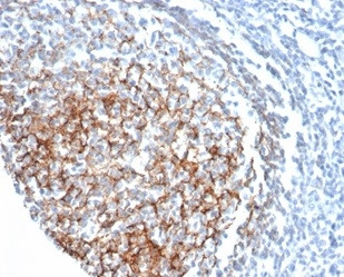 CD35/CR1 (Follicular Dendritic Cell Marker) Antibody in Immunohistochemistry (Paraffin) (IHC (P))