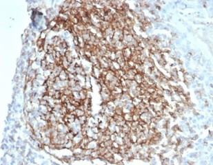 CD35/CR1 (Follicular Dendritic Cell Marker) Antibody in Immunohistochemistry (Paraffin) (IHC (P))