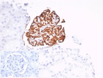 CD35/CR1 (Follicular Dendritic Cell Marker) Antibody in Immunohistochemistry (Paraffin) (IHC (P))