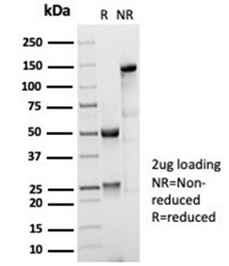 CD35/CR1 (Follicular Dendritic Cell Marker) Antibody in SDS-PAGE (SDS-PAGE)