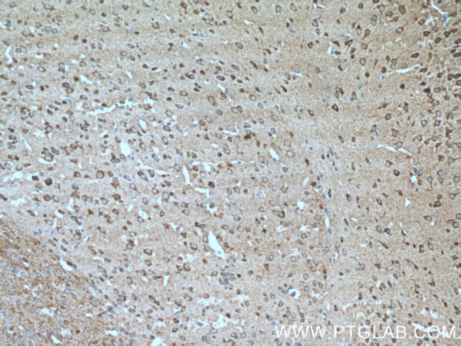 TAC1 Antibody in Immunohistochemistry (Paraffin) (IHC (P))