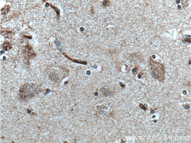 TAC1 Antibody in Immunohistochemistry (Paraffin) (IHC (P))