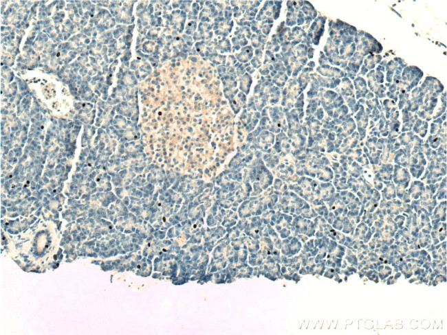 TAC1 Antibody in Immunohistochemistry (Paraffin) (IHC (P))