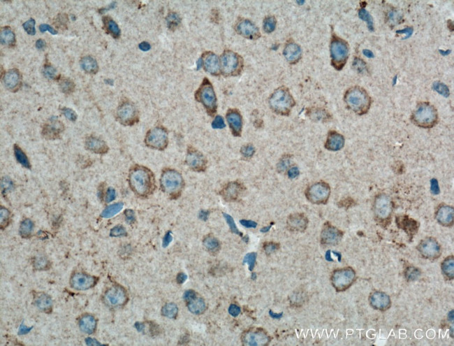 CX3CR1 Antibody in Immunohistochemistry (Paraffin) (IHC (P))