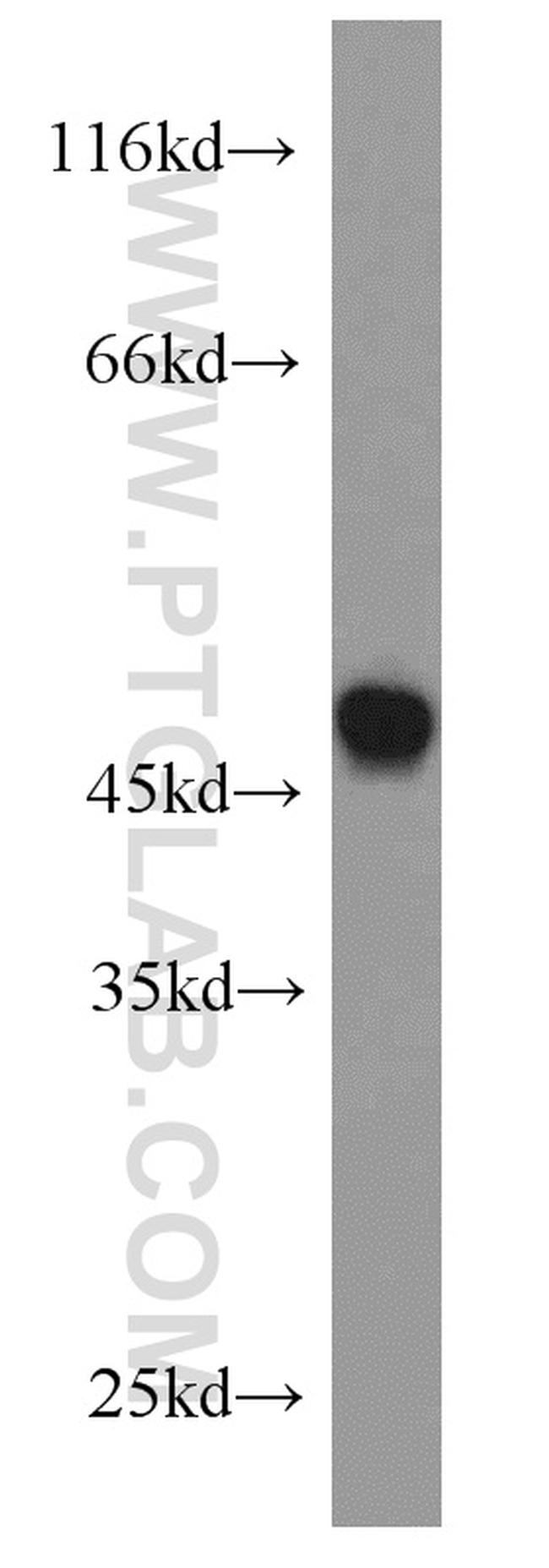 CX3CR1 Antibody in Western Blot (WB)