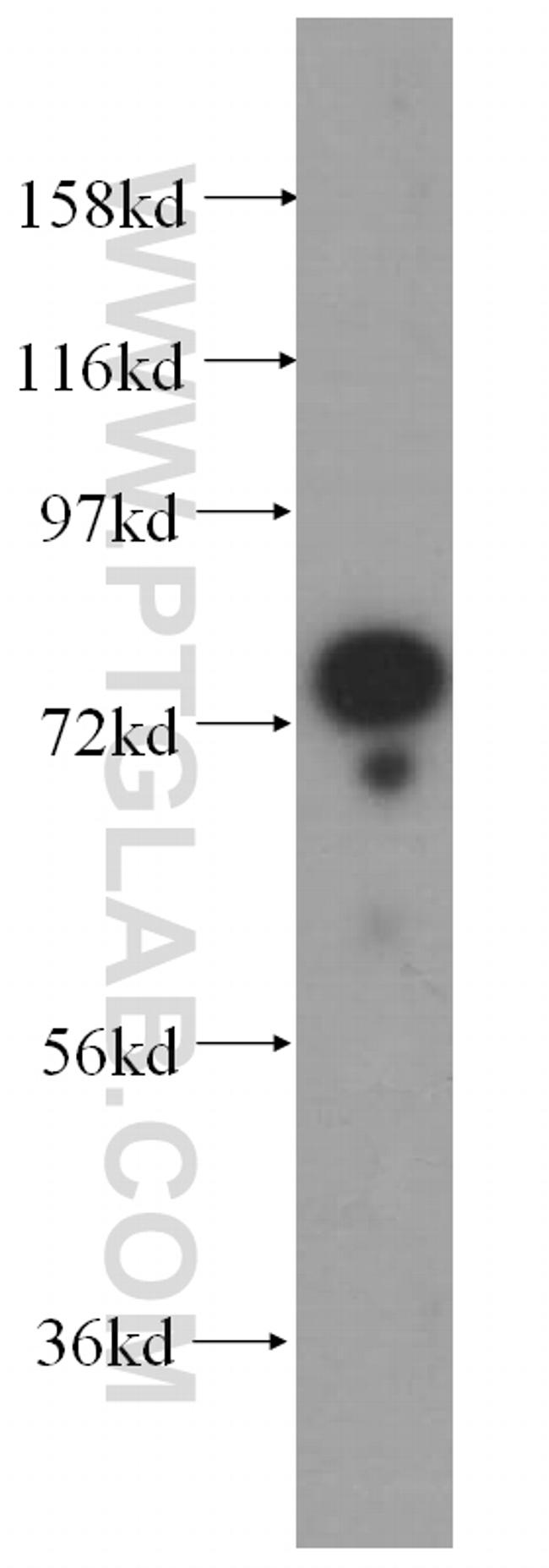 GTPBP4 Antibody in Western Blot (WB)