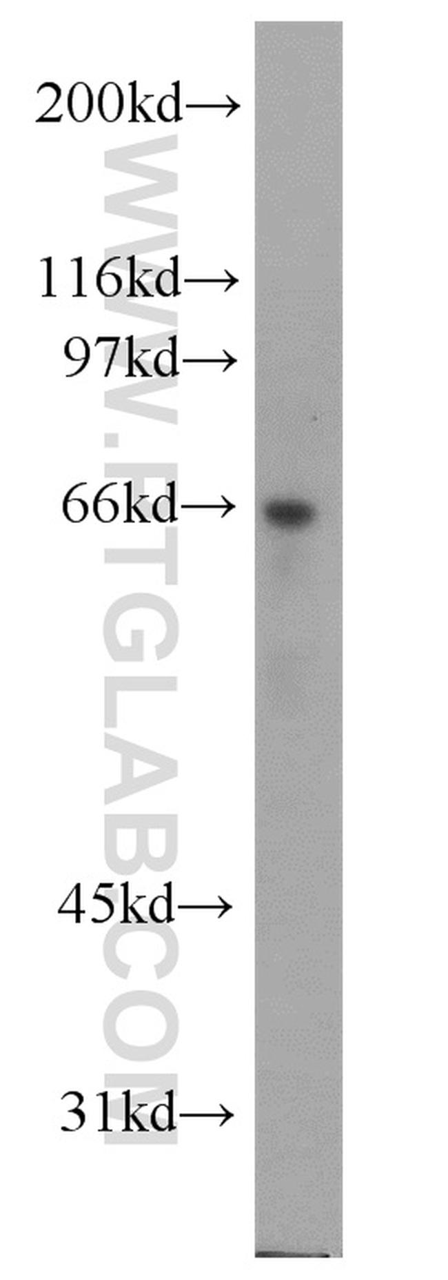 ATE1 Antibody in Western Blot (WB)