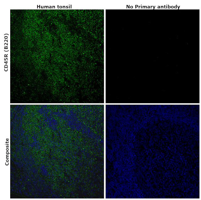 CD45R (B220) Antibody in Immunohistochemistry (Paraffin) (IHC (P))