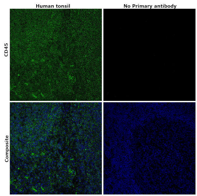 CD45 Antibody in Immunohistochemistry (Paraffin) (IHC (P))