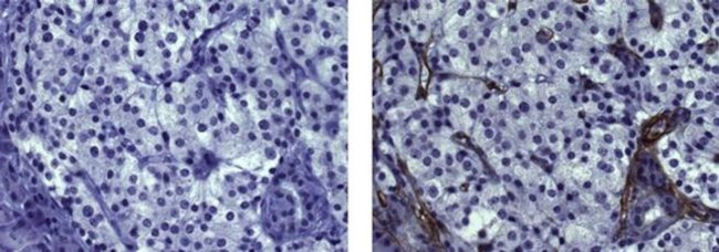 Actin (muscle) Antibody in Immunohistochemistry (Paraffin) (IHC (P))