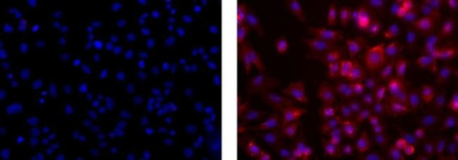 Neural/Glial Antigen 2 (NG2) Antibody in Immunocytochemistry (ICC/IF)