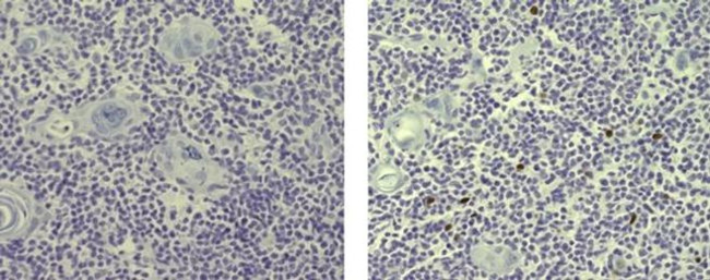 AIRE Antibody in Immunohistochemistry (Paraffin) (IHC (P))