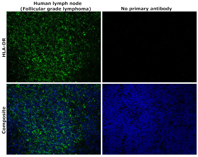 HLA-DR Antibody in Immunohistochemistry (Paraffin) (IHC (P))