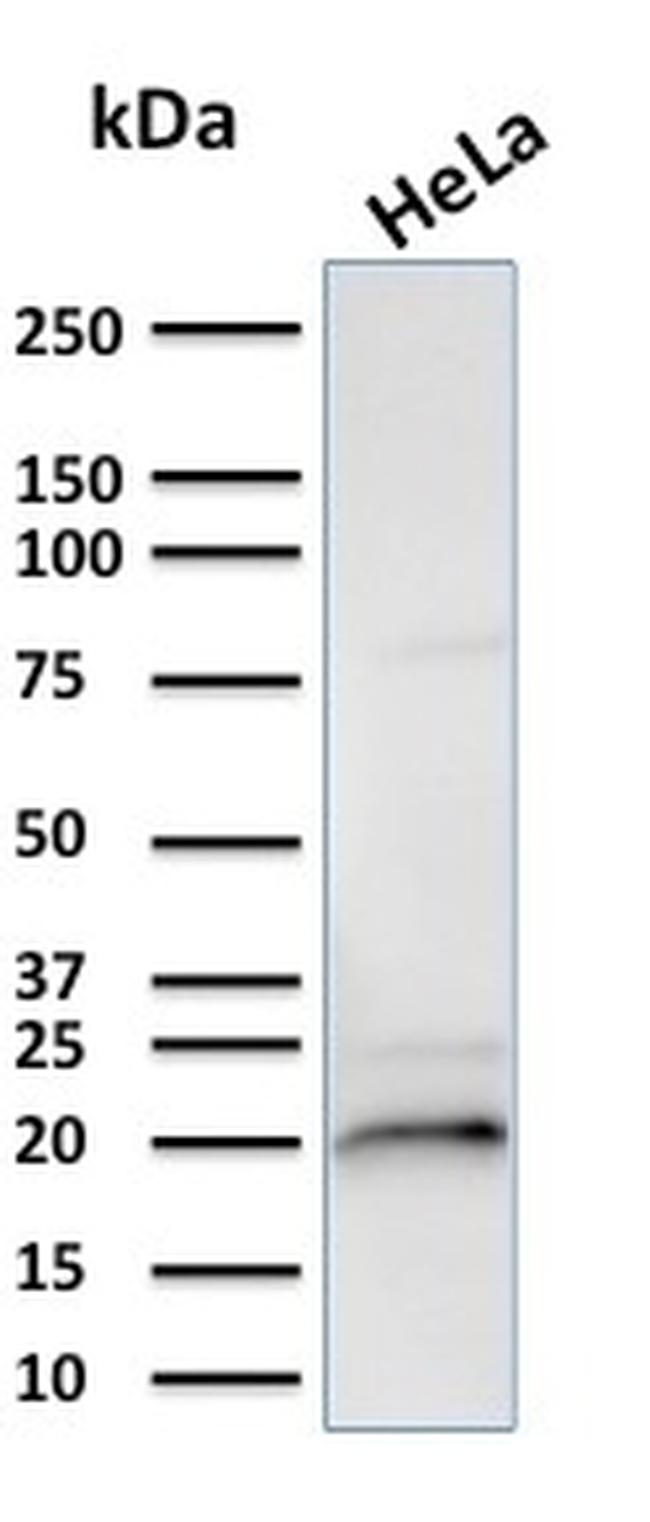 Crystallin Alpha B Antibody in Western Blot (WB)