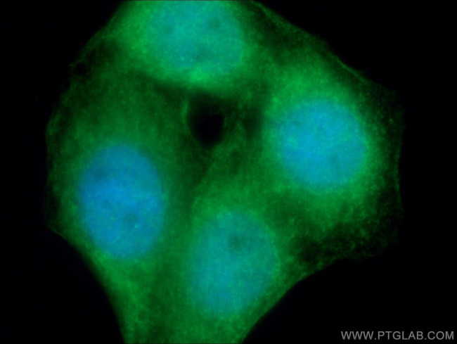 NF-kB Antibody in Immunocytochemistry (ICC/IF)