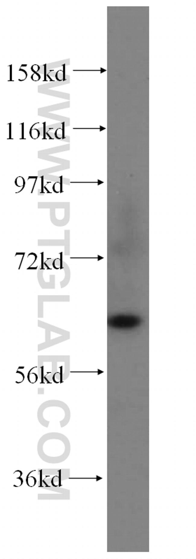 STXBP4 Antibody in Western Blot (WB)