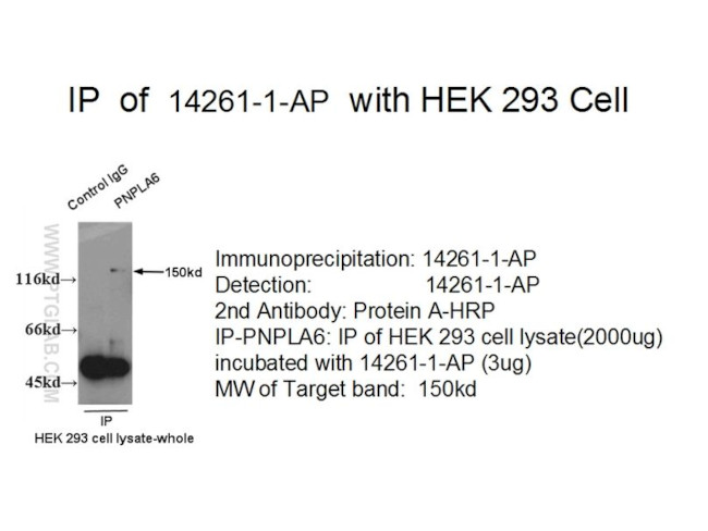 PNPLA6 Antibody in Immunoprecipitation (IP)