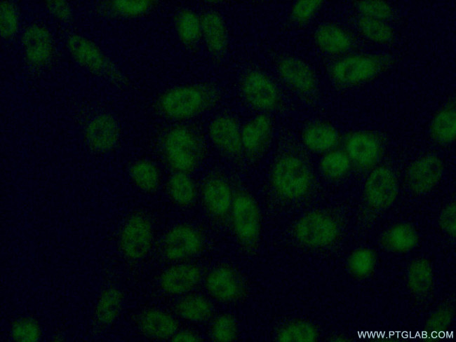 HOXC4 Antibody in Immunocytochemistry (ICC/IF)