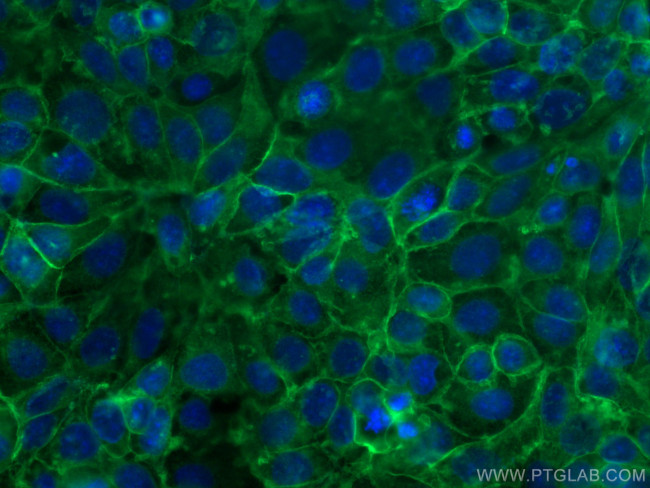 ATP1A1 Antibody in Immunocytochemistry (ICC/IF)