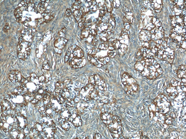 ATP1A1 Antibody in Immunohistochemistry (Paraffin) (IHC (P))