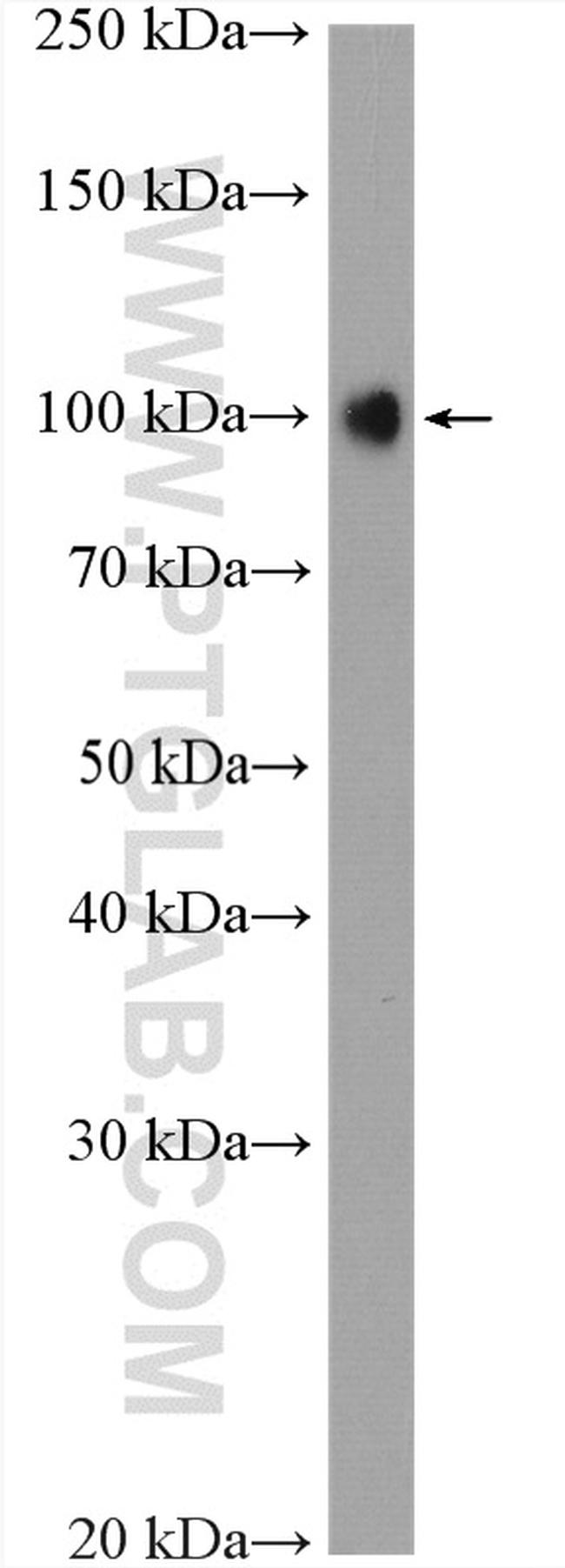 ATP1A1 Antibody in Western Blot (WB)