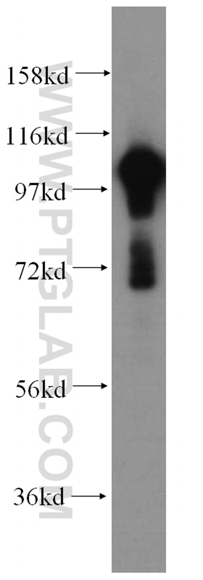 ATP1A1 Antibody in Western Blot (WB)