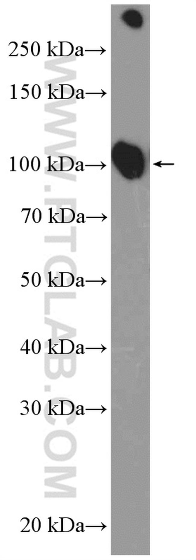 ATP1A1 Antibody in Western Blot (WB)