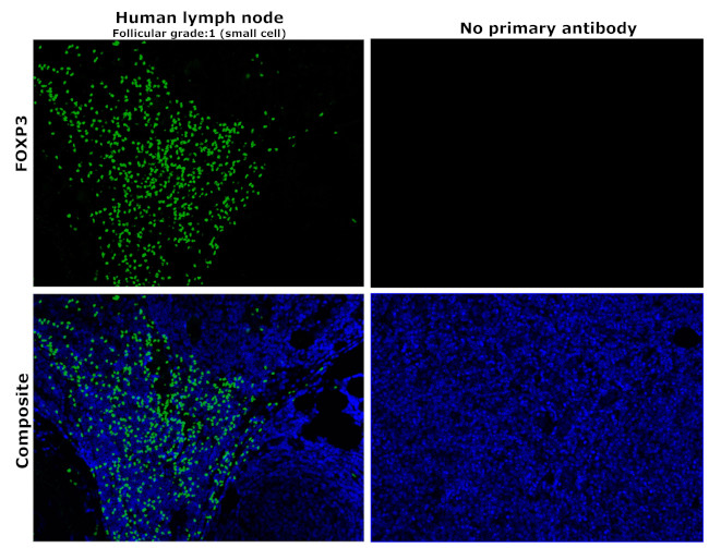 FOXP3 Antibody in Immunohistochemistry (Paraffin) (IHC (P))