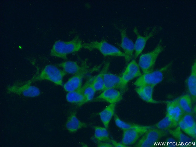 RPL7 Antibody in Immunocytochemistry (ICC/IF)