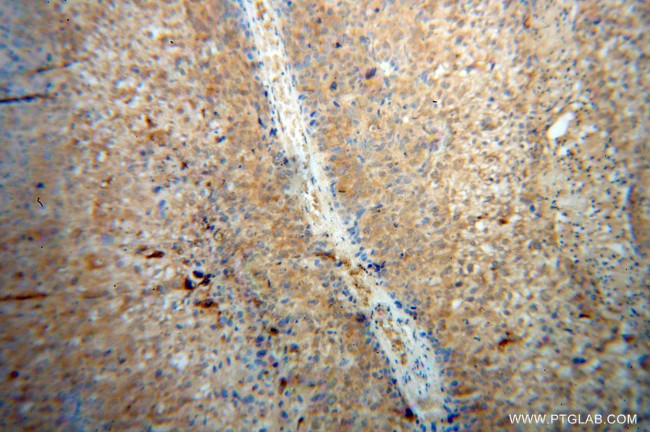 RPL7 Antibody in Immunohistochemistry (Paraffin) (IHC (P))