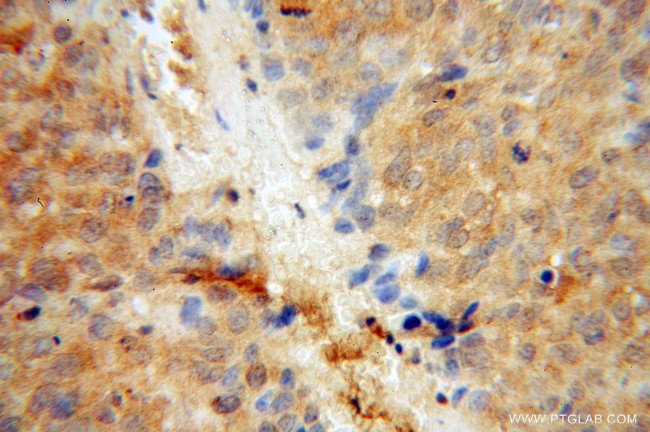 RPL7 Antibody in Immunohistochemistry (Paraffin) (IHC (P))