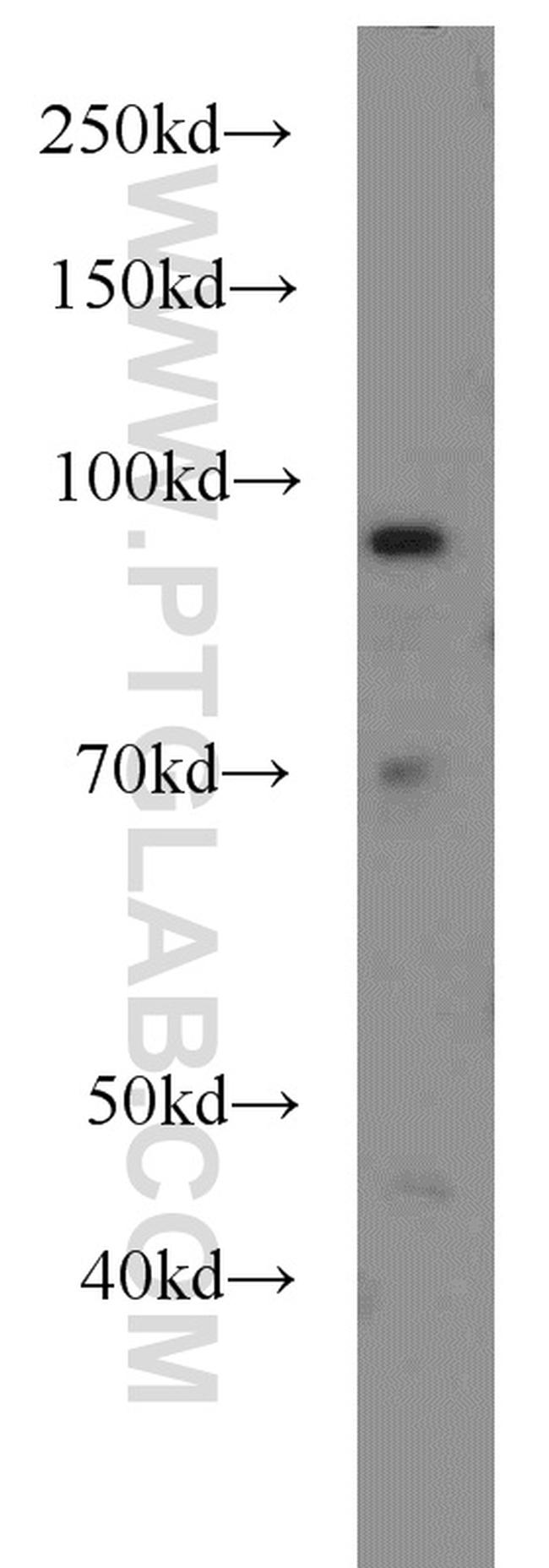 HPS4 Antibody in Western Blot (WB)