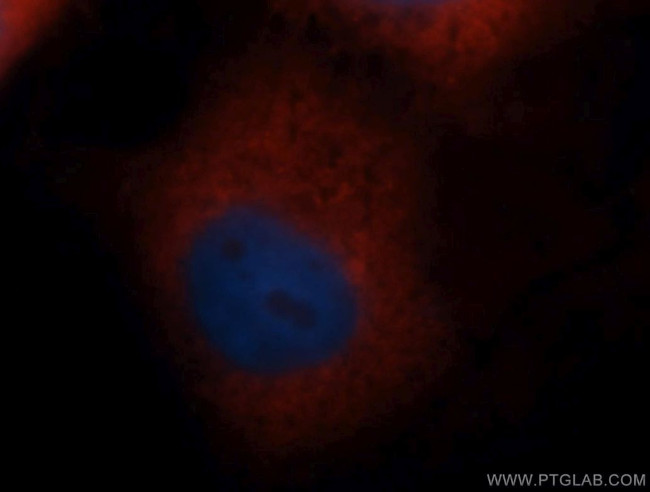 RPS4X Antibody in Immunocytochemistry (ICC/IF)