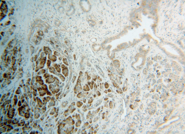 RPS4X Antibody in Immunohistochemistry (Paraffin) (IHC (P))