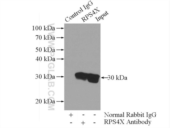 RPS4X Antibody in Immunoprecipitation (IP)