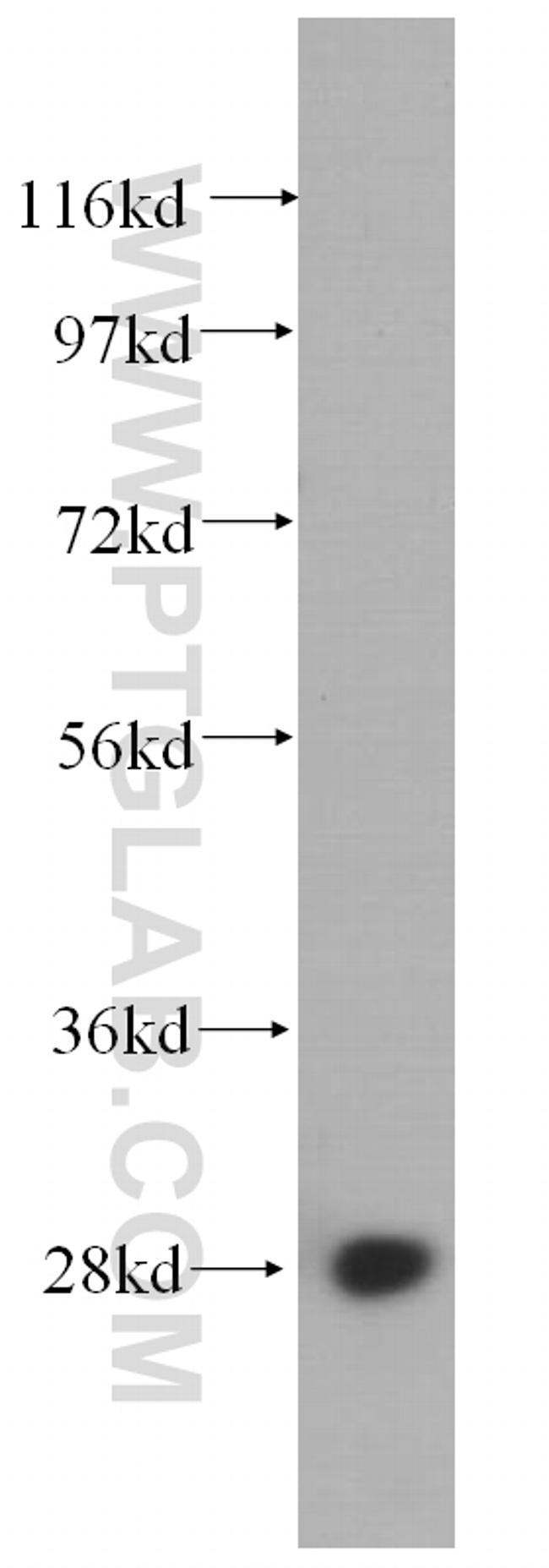 RPS4X Antibody in Western Blot (WB)