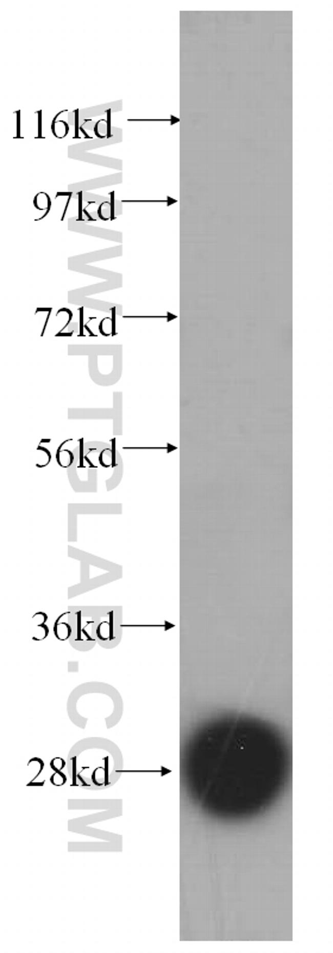 RPS4X Antibody in Western Blot (WB)